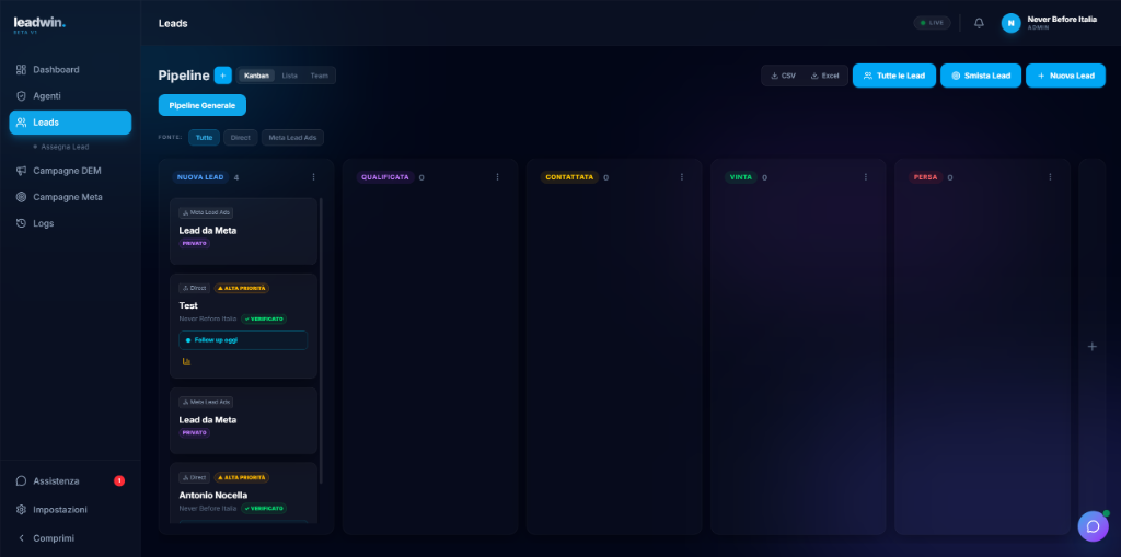 Pipeline Kanban View